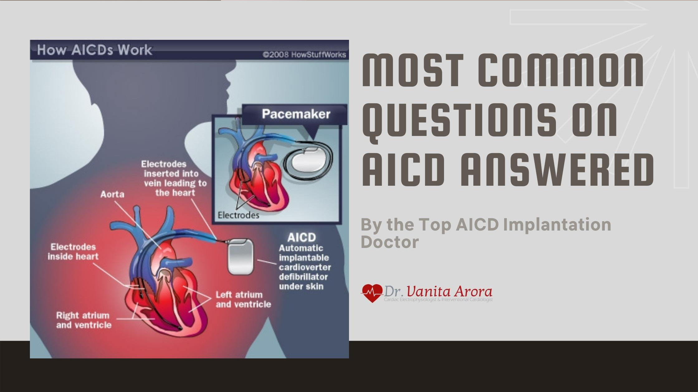 Most Common Questions on AICD Answered by the Top AICD Implantation Doctor