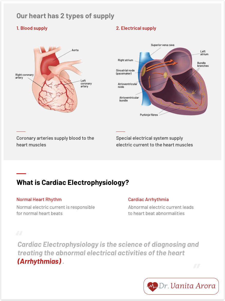 arrhythmia