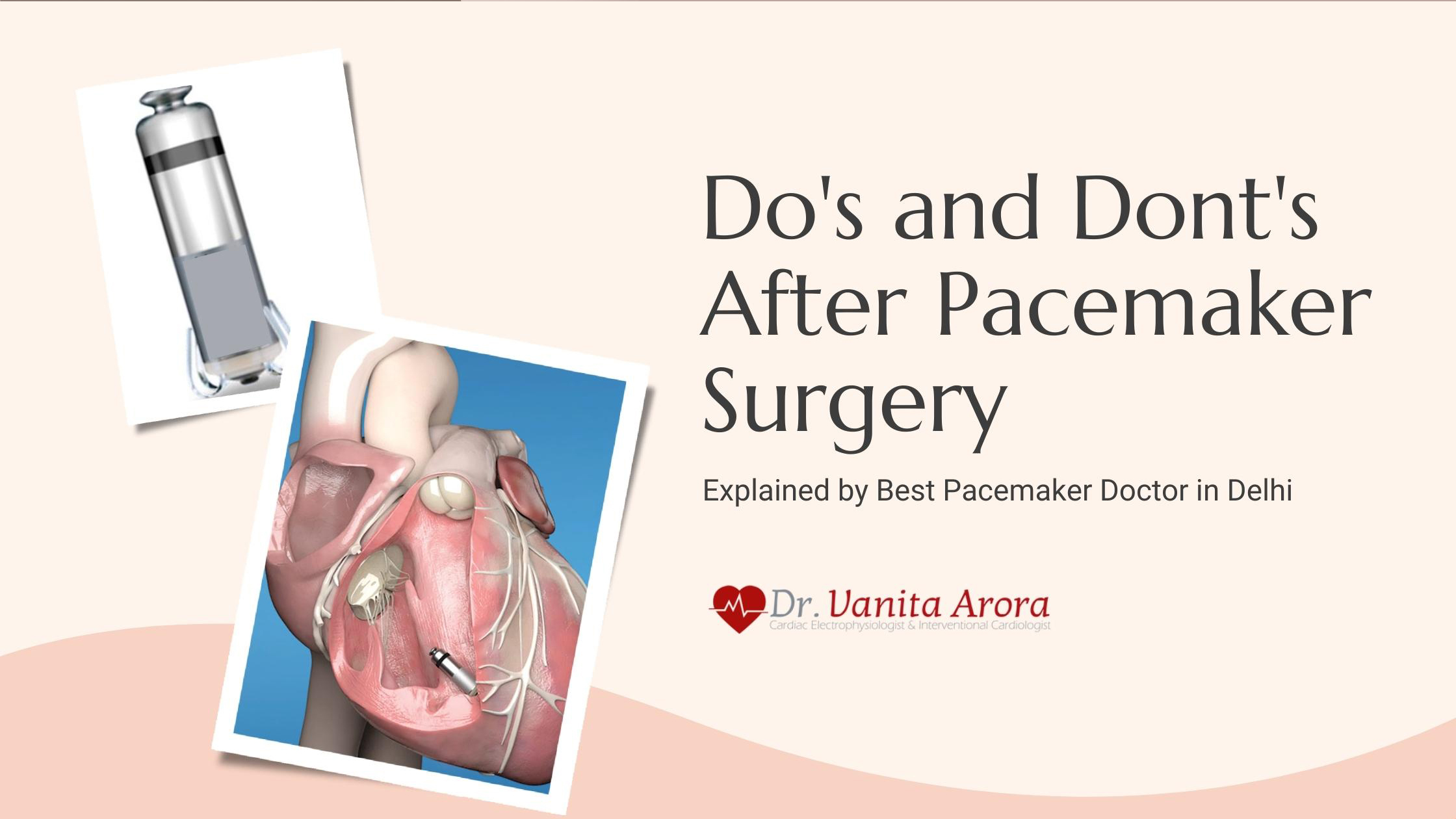 best pacemaker surgeon in India