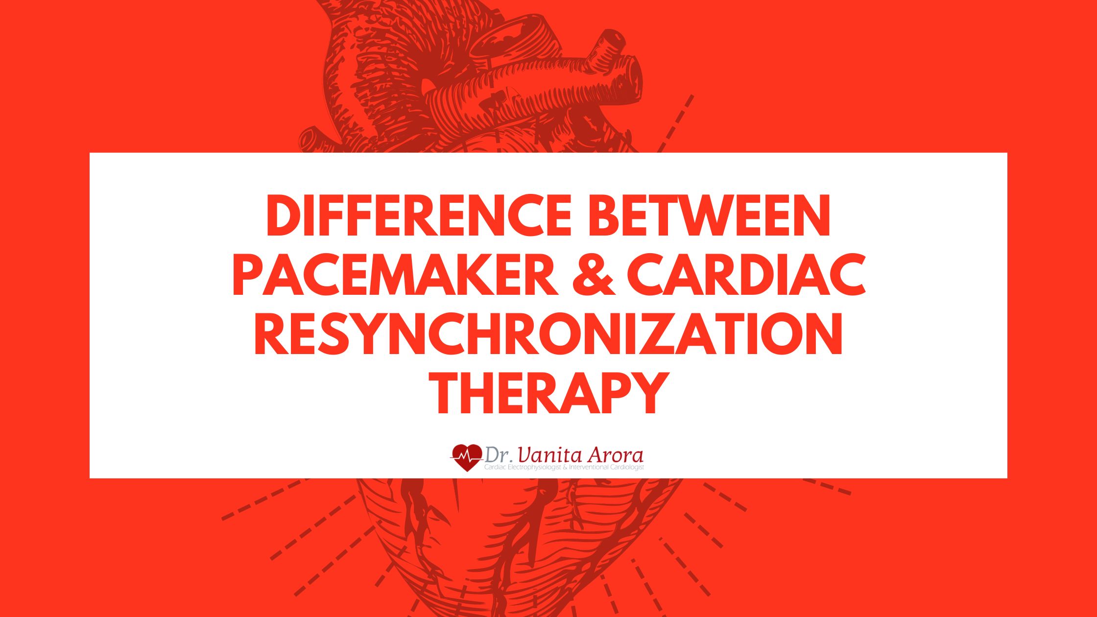 Difference Between Pacemaker & Cardiac Resynchronization Therapy