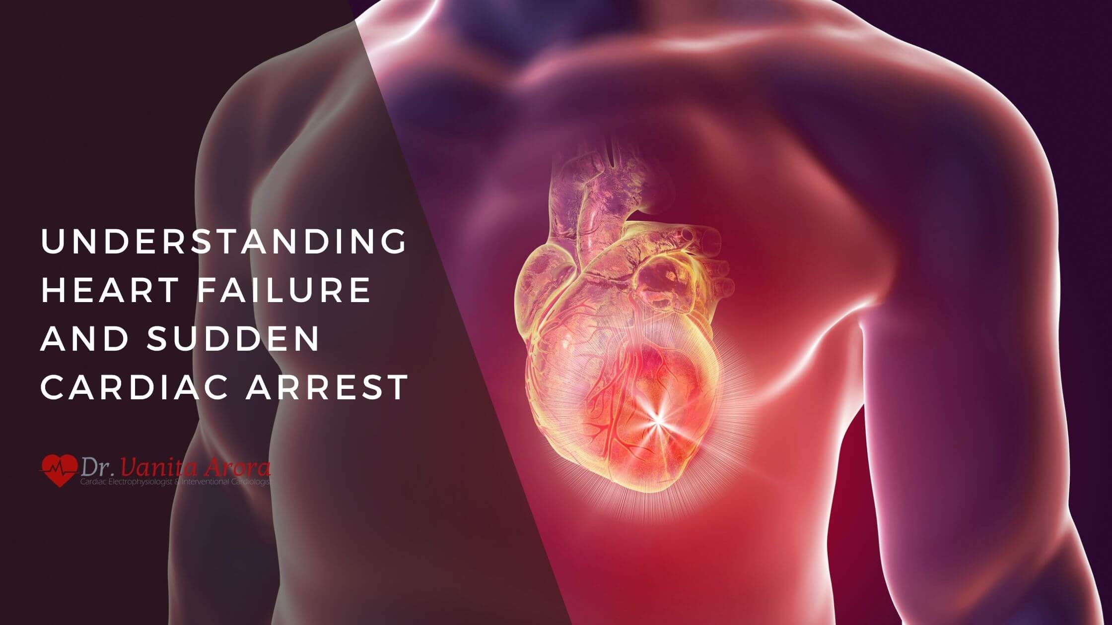 How is Sudden Cardiac Dysfunction (SCD) different from a heart attack?